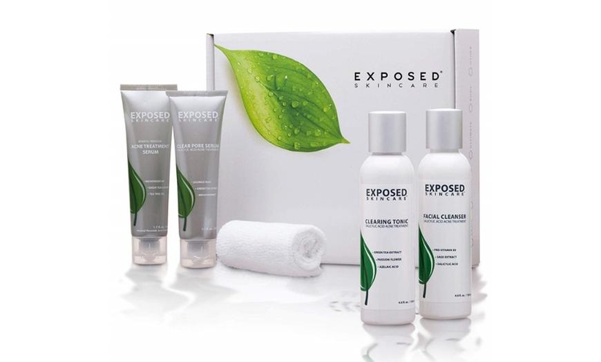 Exposed Skin Care Reviews It Is Legit Or Scam exposed-skin-care-reviews
