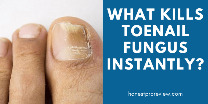 what kills toenail fungus instantly?