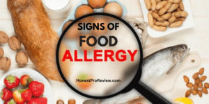 signs of food allergies